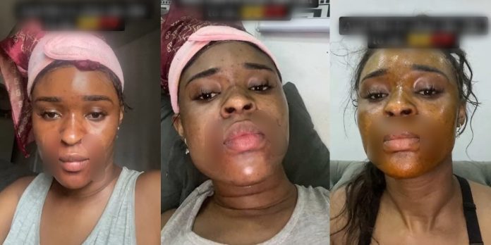 “What did I do to deserve this?” – Lady cries out after her mother’s househelp tried to disfigure her face (video)