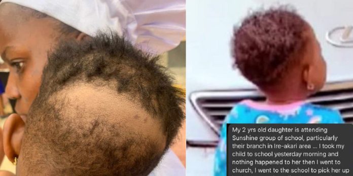 Mom raises alarm after her two-year-old daughter’s hair was allegedly scraped in school with incisions in Ibadan