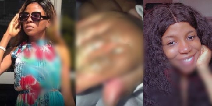 Lady scalds her 2-months-old son’s hand with hot water over a misunderstanding with her baby-daddy in Rivers State