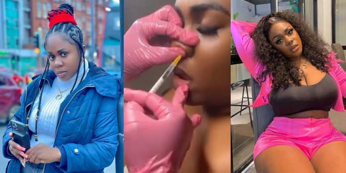 Netizens reacts as skit maker, Nons Miraj gets Botox nose job (Video)