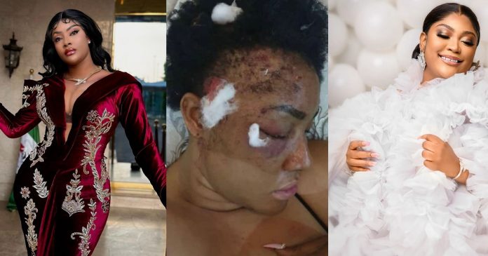 Angela Okorie calls out friend, Uche Elendu for sending video of her in pain to blogger