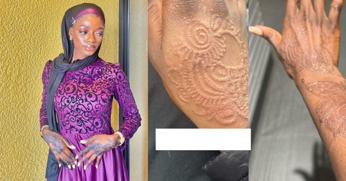 Nigerian lady with sensitive skin got permanent tattoo after getting a Henna (WATCH)