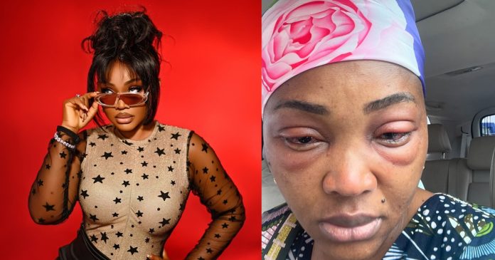 Actress Mercy Aigbe recounts how she battlɘd eye infect!on while filming her new movie (IMAGES)